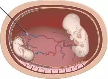 欧美日韩综合在线精品 更推动了文化交流与创新