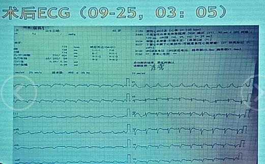 ？视频 编码、视频我也可以尽力解答