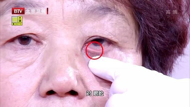 小蓝视频免登录版