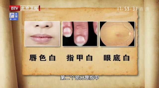 老款榴莲视频app让你榴莲忘返 忘返调整设置能让观看更舒适